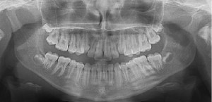 Read more about the article Sending Dental Xrays